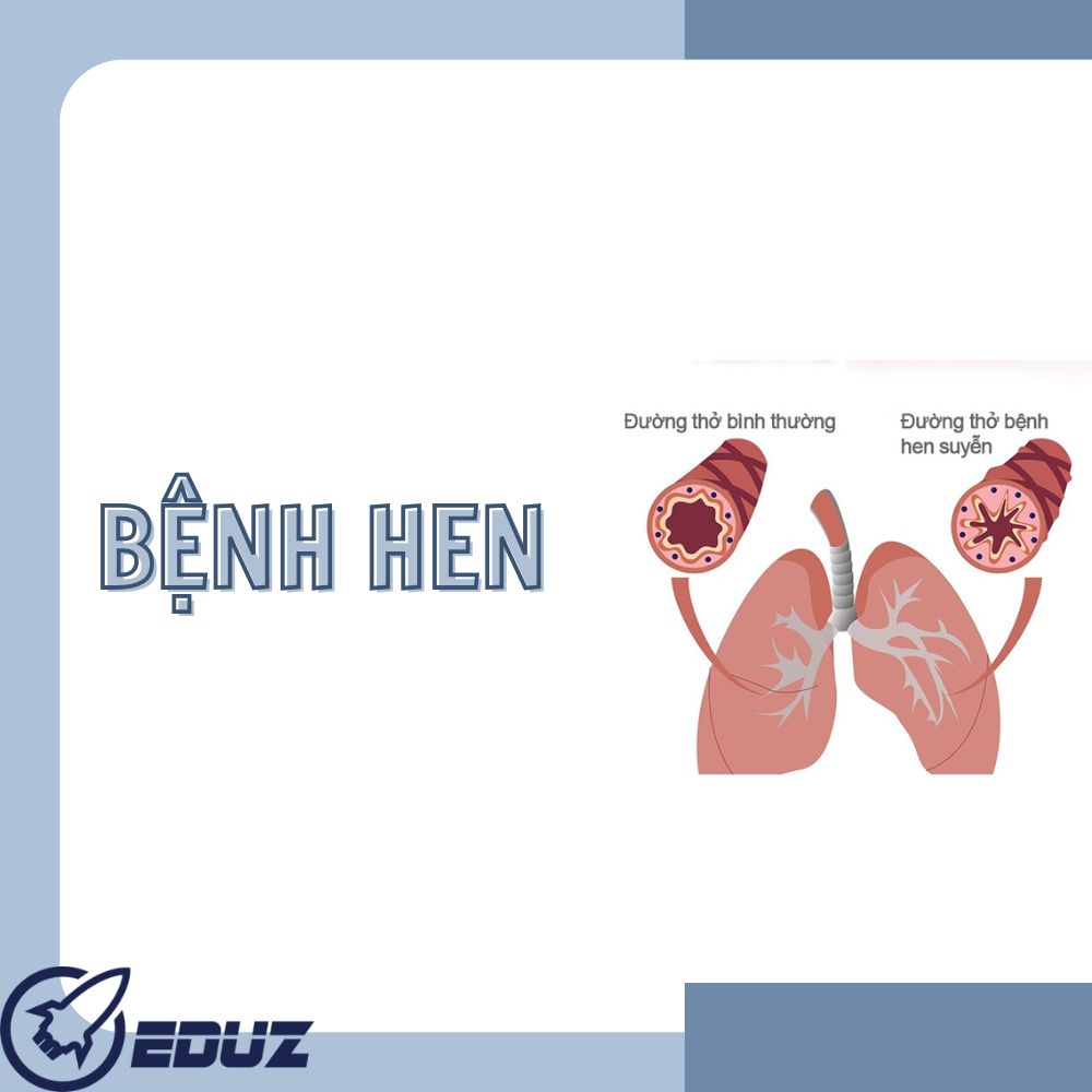 Sơ cấp cứu thường thức - Hen